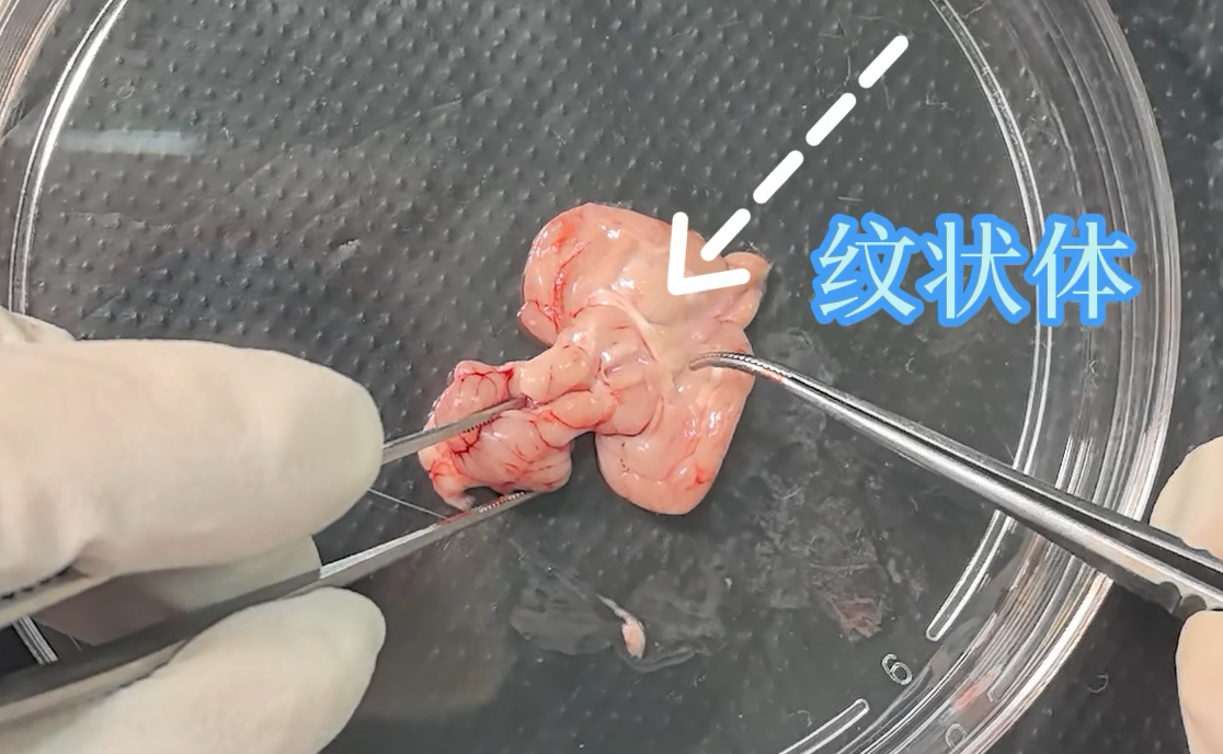 纹状体.png